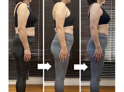 たけのこの写真