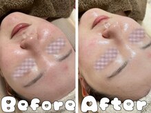 グラシア 倉敷店(Gracia)/お客様の施術事例