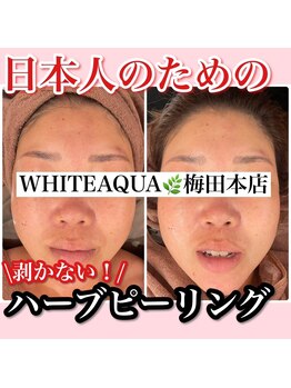 アルムダアクア 天王寺店(Aleumda AQUA)/ハーブピーリング/大阪/天王寺