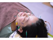 和緩堂の雰囲気(美容鍼でエラ張り、むくみ、食いしばり、小顔に♪)