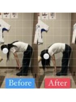 ナオル整体 宮崎院(NAORU整体)/20代女性施術事例【腰痛改善】