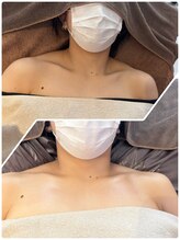 アールプラス(R+)/呼吸が変わる施術