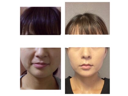 サロン ド ルポゼ(Salon de Reposer)の写真