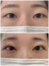 マドモア 飾磨店(MADEMORE)/【ダブルアイリフト】驚きの効果