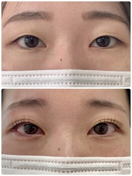 マドモア 飾磨店(MADEMORE)/【ダブルアイリフト】驚きの効果