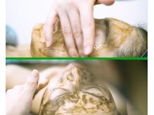 クレドペール(Eclat de Perles)/あらゆる肌トラブルの改善に！