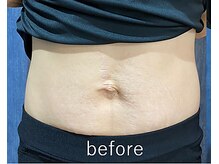 カナウ(kanau)/トリプルボディシェイプ