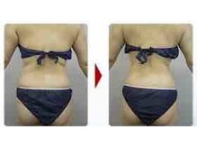 ブランシェ 野々市店 × 椿/筋膜セラピー効果