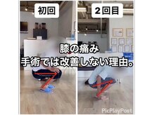 カワル整体 上通り院/膝の痛みが良くならない理由