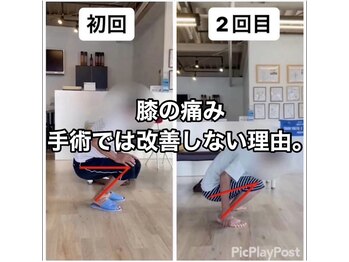 カワル整体 上通り院/膝の痛みが良くならない理由