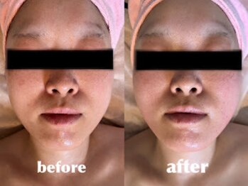 エステティックサロン フェアリー(ESTHETIC SALON FAIRLY)/むくみ/食いしばりは即解消◎