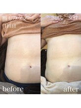 ステライチマルサン(stella.103)/よもぎ蒸し＋腸もみケア