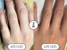 身だしなみラボ(MIDASHINAMILABO)/結構見られてます指の毛