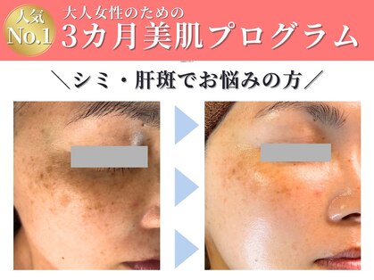 キレイ(KIREI)の写真