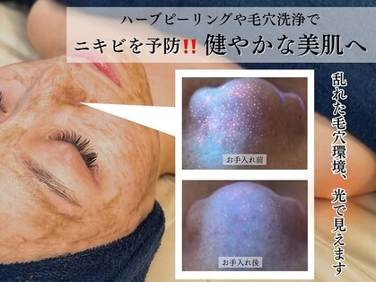 小顔コルギ・美肌サロン Pul Beaute 吉祥寺 [ハーブピーリング / 毛穴洗浄 / ニキビ]の写真