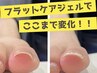 【巻き爪矯正】フラットケアジェル¥4500