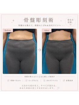 プリマプリート 各務原店/骨盤の歪みが気になる方に