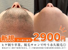 ボス 大曽根店(BOSS)の雰囲気(最短期間で脱毛完了#シェービング#ヒゲ脱毛#メンズ脱毛)