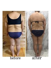 ラニ(LANI)/キャビテーション