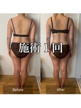 サロンツキ(salon tuki)/【バストケア】症例★