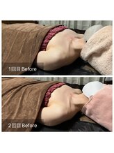 リノレア(LinoLea)/バストアップBefore after