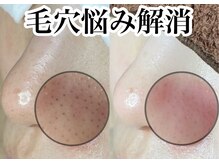アンドピエル(AndPiel)の雰囲気（変化の分かるフェイシャル専門店で満足の仕上がり！）
