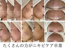 シェノン
