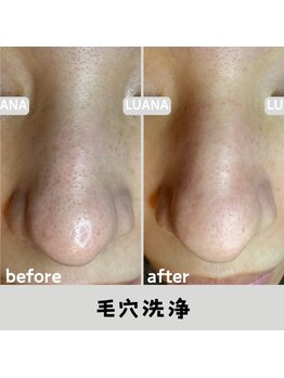 ルアナ 北谷店/毛穴洗浄毛穴ケア 《沖縄/北谷》