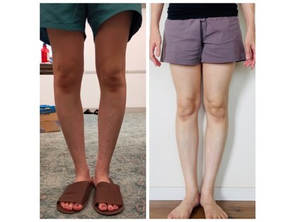 めぐらせの森の写真