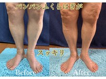 ケイ プレジール/浮腫みスッキリ炭酸フットケア