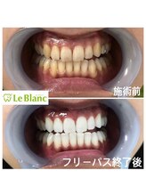 ルブラン 奈良店(Le Blanc)/夏がやってきます！！