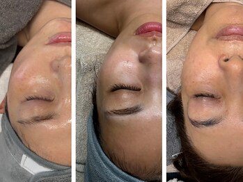 テン 仙台(10n.)の写真/ハリ・ツヤのある肌へ◎乾燥やくすみを繰り返さない肌づくり