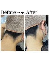 クリア アイラッシーズ アンド ネイルサロン シャイン(CLEAR & SHINE)/うなじ美人☆後ろ姿も美しく♪