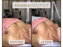 シストワ(sistoi)/★☆★バストUP★☆★