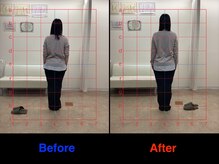 整体院 仁(JIN)/#骨盤#矯正#猫背#だるさ#疲れ