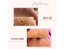 フェリス(Feliz)の雰囲気（魚の目でお悩みの方も当サロンにお任せください！！）