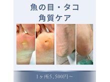 巻き爪補正店 札幌店の雰囲気（落ち着いた雰囲気で施術を受けていただけます）