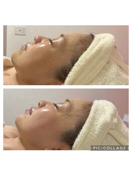 BBC 田園調布/小顔コルギ効果