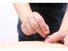 【初めての方にも◎】つらい所を集中施術。鍼灸40分/担当：シマベ