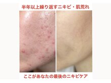 小顔コルギサロン シー(She)