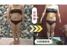 ルル(Lulu's)の雰囲気（ほぐし術90分(2週に1回ペースで施術)脂肪ほぐし(2回施術)）