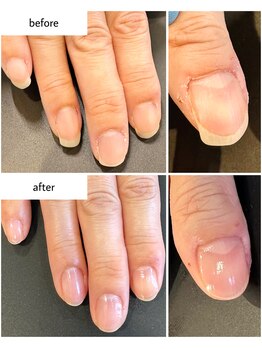 ケアプラス(care plus)/ハンドネイルケア