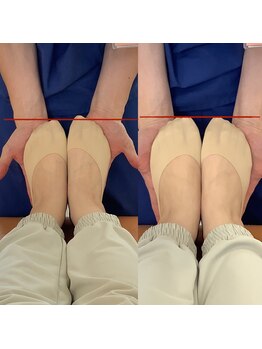 きずな鍼灸整骨院 武蔵ヶ丘本院/骨盤の歪み