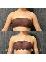 ヒヨリ(hiyori)/《before/after》上半身