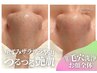 【満足度No.1】W毛穴洗浄コース／お顔全体（約75分）