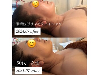 ステライチマルサン(stella.103)/眼精疲労フェイシャル