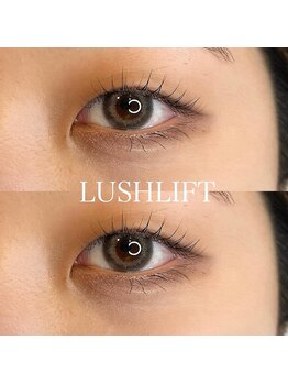 リンド エステ まつげ 京成大久保(Lind)/ラッシュリフト