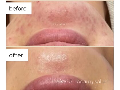 ウェヌ(VENE)の写真