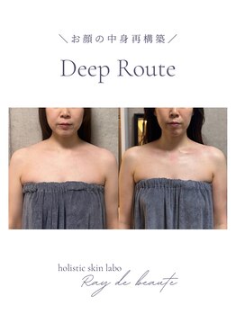 レイドボーテ(Ray de beaute)/