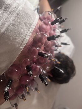 ユラン(YURAN)/カッピング